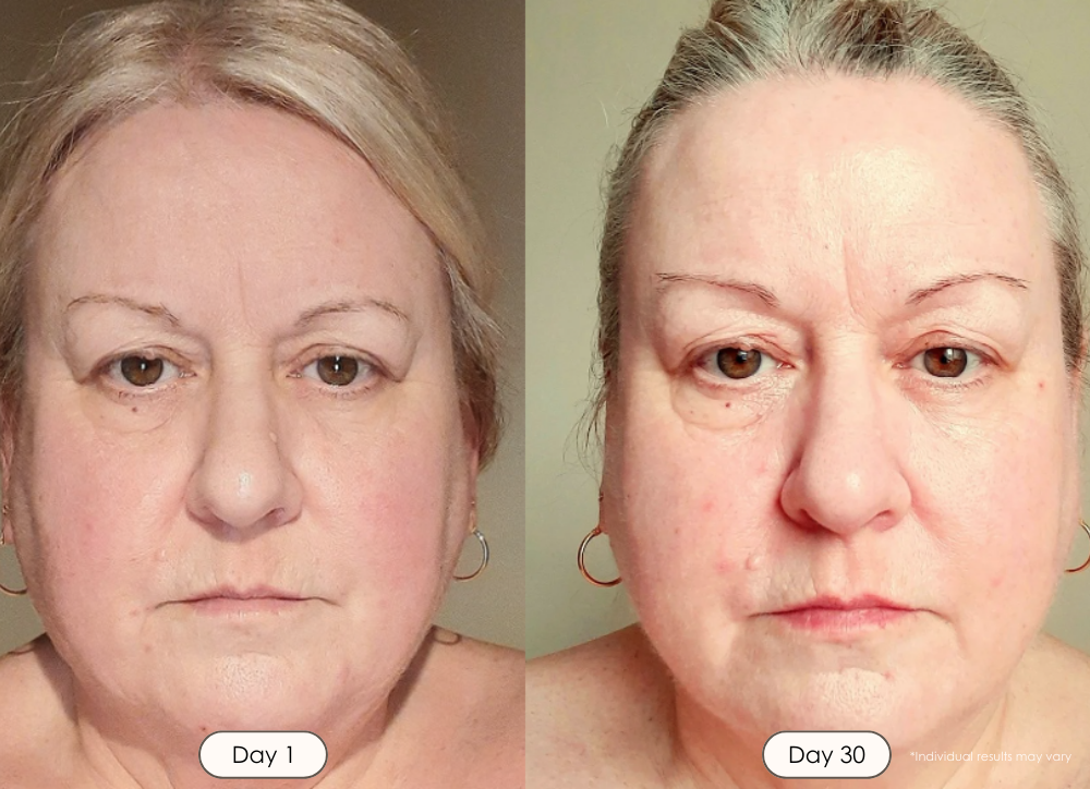 Lumamask Pro LED light therapy face mask before and after results showing reduced fine lines