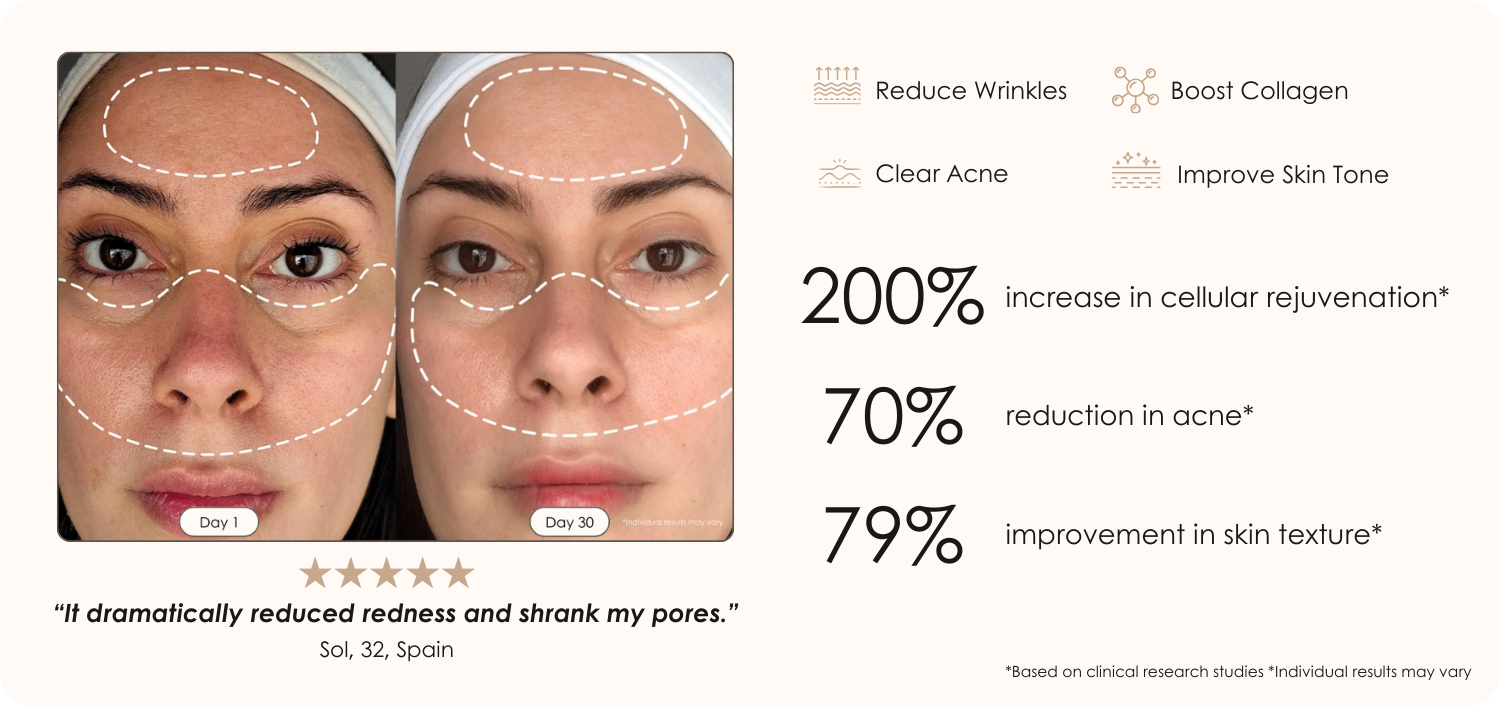 Lumamask Pro LED light therapy face mask before and after results showing smaller pores and reduced redness